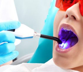 Dr. Russell Borth, Corpus Christi dentist does Composite Fillings
