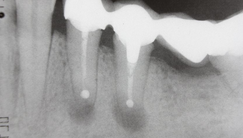 Dr. Russell Borth recommends Dental X-rays