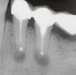 Dr. Russell Borth recommends Dental X-rays